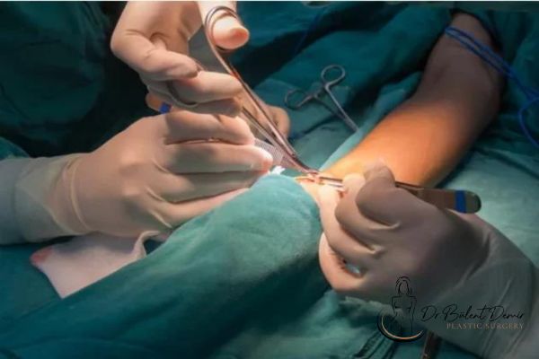 Ameliyat Sonrası Enfeksiyon Belirtileri Antalya