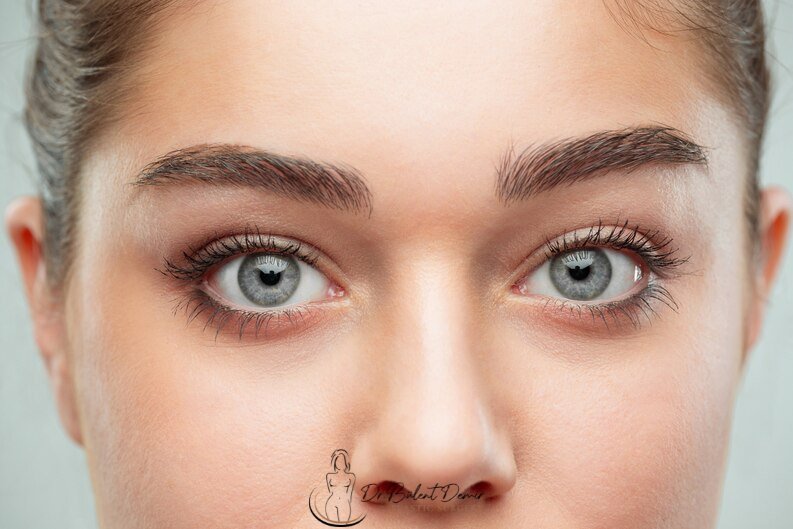 Eyelid lift-blepharoplasty Eyelid lift (blepharoplasty) in Antalya,Turkey